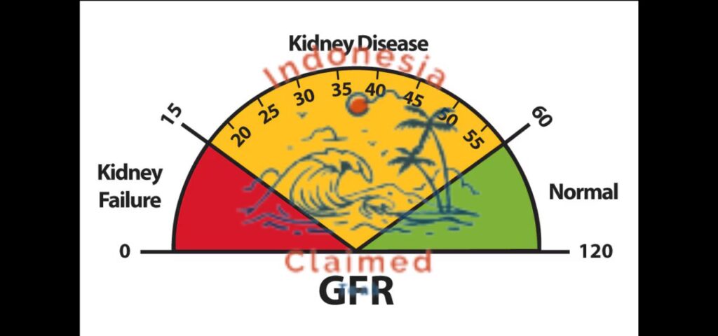 Fasting Not Recommended for Patients with Kidney Function Below 40