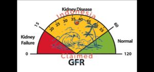 Fasting Not Recommended for Patients with Kidney Function Below 40